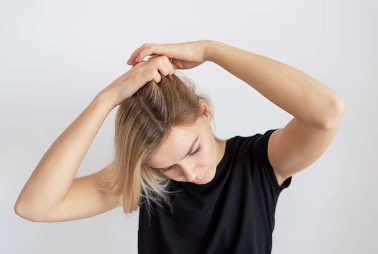 Rambut Rontok Mengganggu? Atasi dengan Bahan Alami!