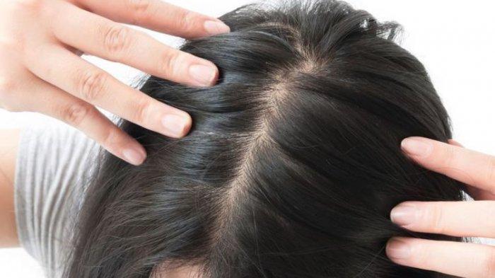 Methylation: Proses Penting untuk Kesehatan Rambut Anda