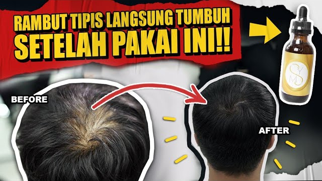 Kemiri: Rahasia Alami untuk Rambut Halus dan Lembut