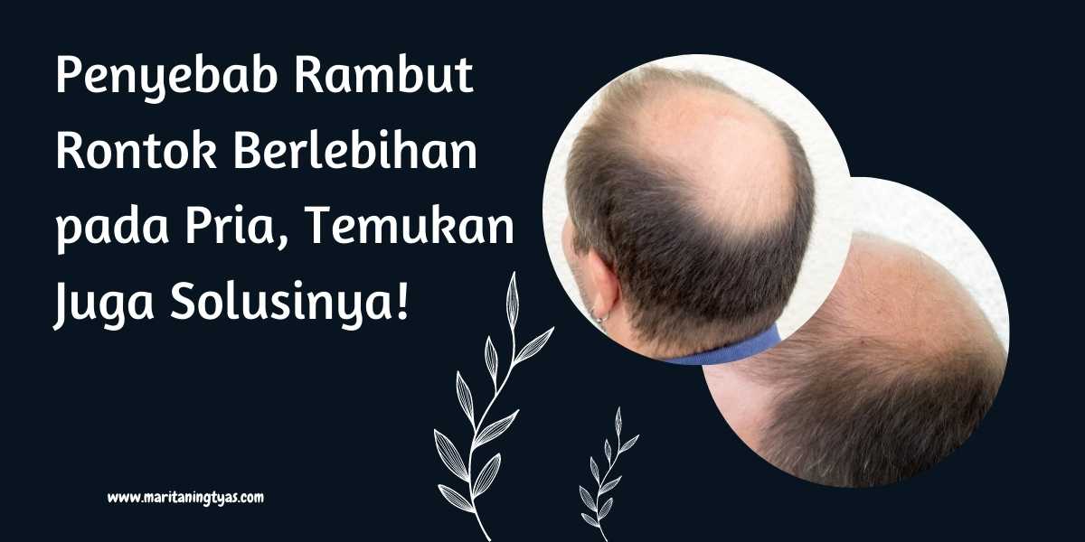 Rambut Rontok Setelah Operasi Caesar: 12 Tips untuk Pemulihan Rambut yang Sehat