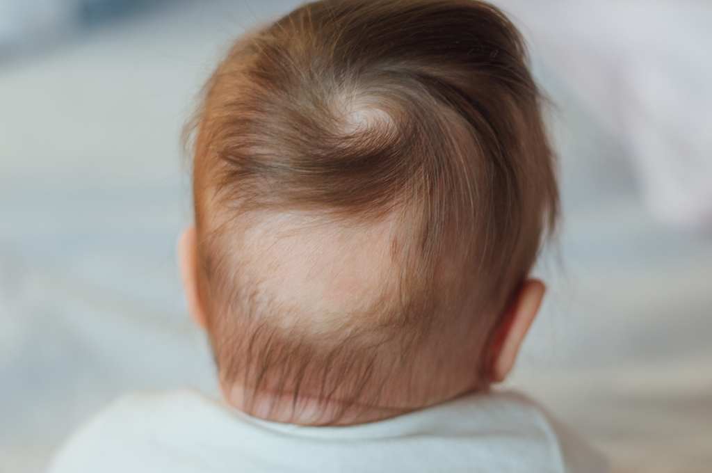 Rambut Rontok pada Anak: Jangan Panik, Solusi Ada!