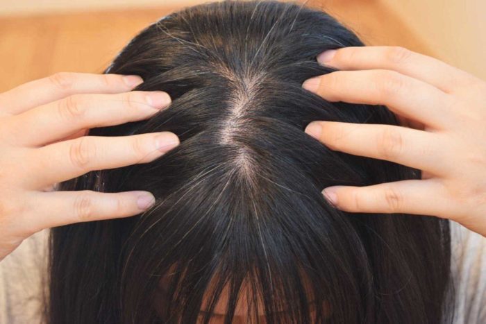 Perangi Rambut Berminyak: Tips Jitu untuk Wanita Berambut Lepek!