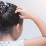 Rambut Rontok pada Anak: Jangan Panik, Solusi Ada!