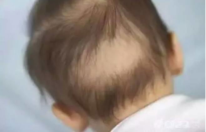 Rambut Anak Rontok? Tenang, Ini Rahasia Merawatnya!