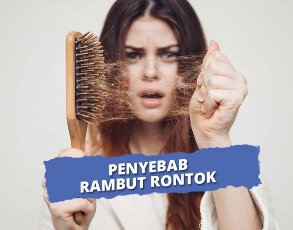 Bagaimana Hormon Memengaruhi Rambut Rontok? Ini Penjelasannya