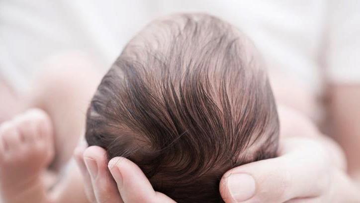 Solusi Aman Mengatasi Rambut Rontok pada Bayi: Tenang, Ini Bukan Masalah Besar!