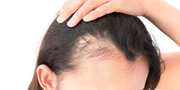 Mengapa Rambut Rontok Saat Menyusui? Solusi dan Tips Mengatasinya