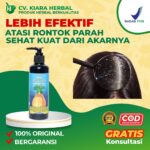 Obat untuk Rambut Rontok yang Parah: 12 Rekomendasi yang Bisa Anda Coba