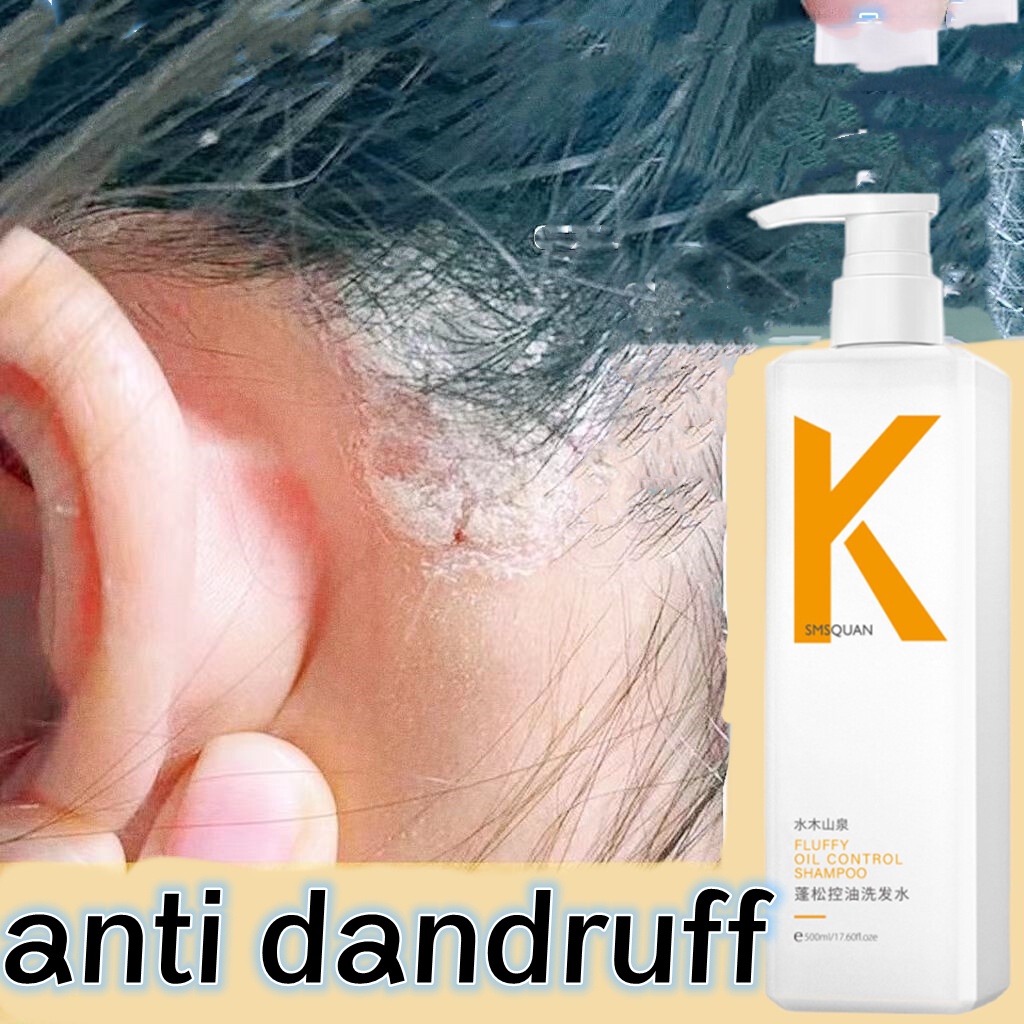 Shampoo Terbaik untuk Kulit Kepala Gatal dan Berketombe: 12 Rekomendasi Terbaik untuk Anda