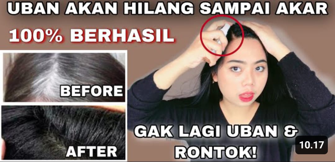 Rekomendasi Shampo Terbaik untuk Rambut Beruban: Taklukkan Uban dengan Rambut Sehat dan Berkilau!