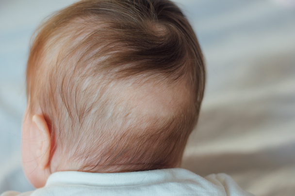 Bayi Rambut Rontok: Normal atau Ada Masalah?