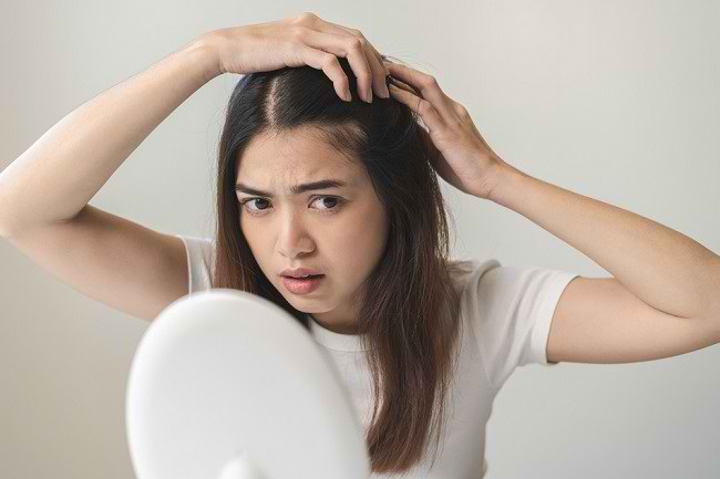 Rambut Rontok Parah? Tenang, 12 Solusi Ampuh Ini Bisa Membantumu!