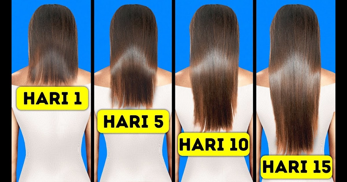 Apakah Rambut Panjang Menyebabkan Jerawat? Mitos atau Fakta?