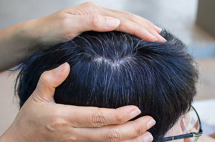 Apa Penyebab Rambut Anak Bisa Kusut? Ini Jawabannya!