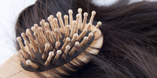 Rambut Lepek? Mungkin Tubuhmu Kekurangan Nutrisi!