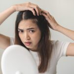 Rambut Rontok Tak Terkendali? Atasi Kebotakan Akibat Penyakit dengan Tips Ini!