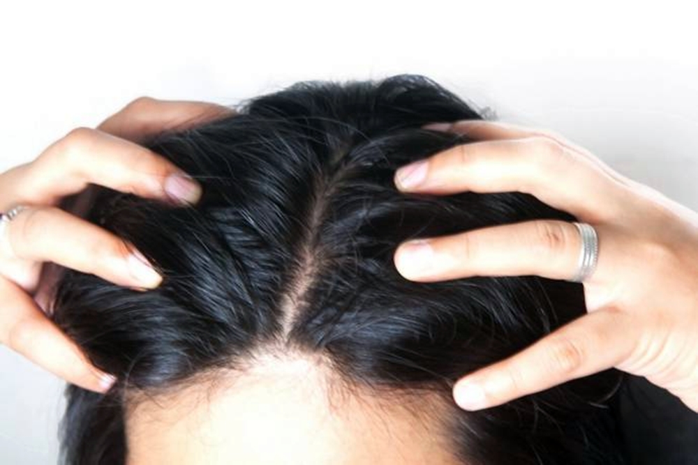 Rambut Rontok? Mungkin Kekurangan Protein! Solusi Sederhana untuk Rambut Sehat dan Kuat