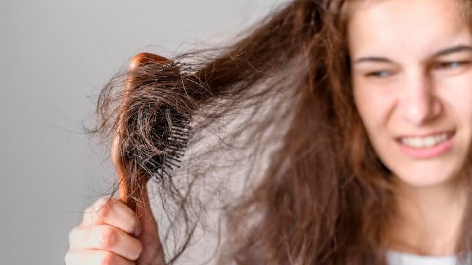 Menyingkirkan Bayangan Rambut Rontok Pasca Melahirkan: Panduan Lengkap untuk Kembalikan Kepercayaan Diri