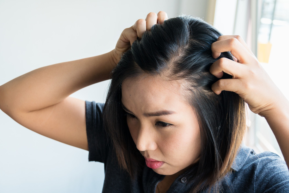 Rambut Lepek Tak Perlu Panik! Simak Tips Merawatnya Agar Tetap Segar dan Bervolume