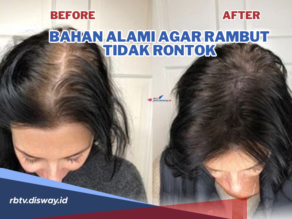 Rambut Rontok dan Kering? Tenang, Ini Solusinya!