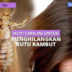 Hilangkan Kutu Rambut dengan Bawang Putih: Solusi Alami yang Efektif?