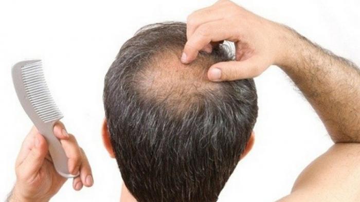 Rambut Rontok? Mungkin Ususmu Sedang Berteriak Minta Pertolongan!