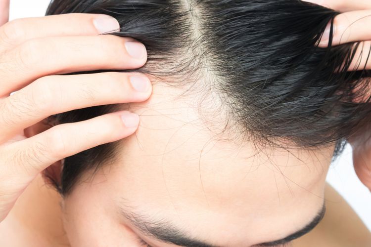 Rambut di Dahi: Mengapa Bentuknya Berbeda-beda?