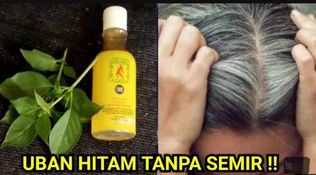 Rambut yang Tercabut Sampai Akar: Bisakah Tumbuh Kembali?