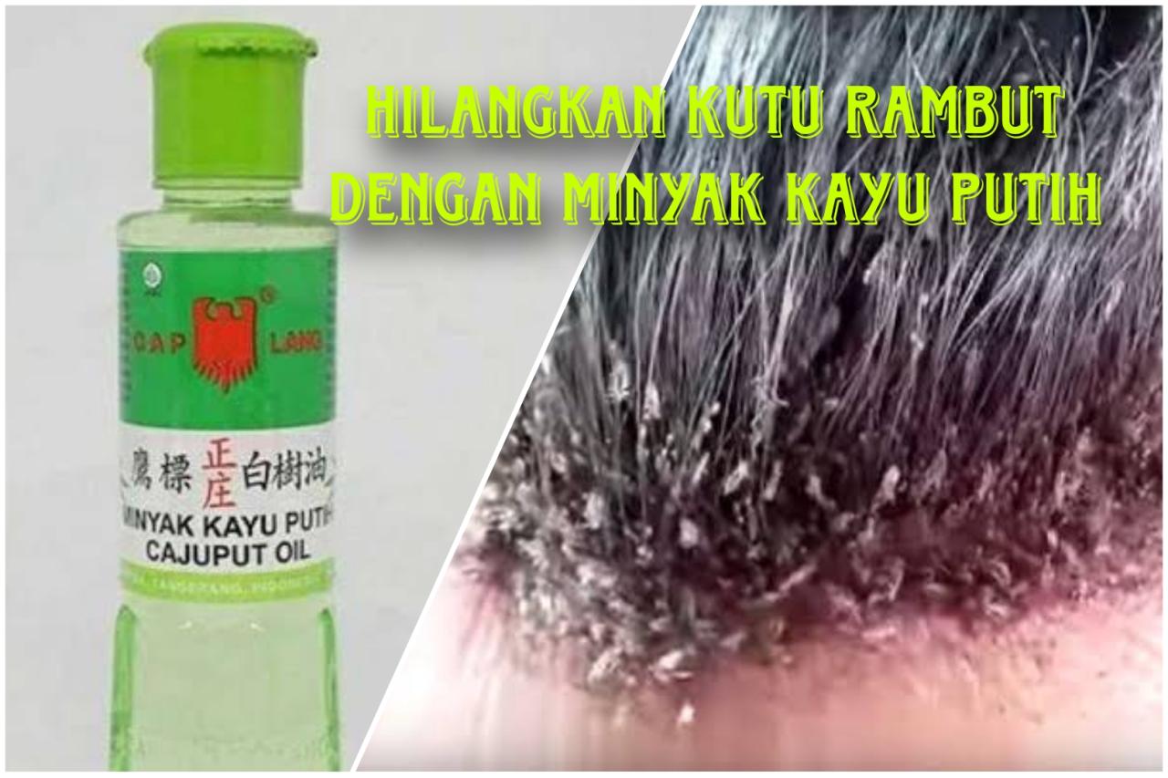 Ucapkan Selamat Tinggal pada Kutu Rambut dengan Minyak Eucalyptus!