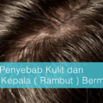 Rambut Berminyak: Penyebab dan Solusi untuk Menyingkirkan Kilau yang Mengganggu