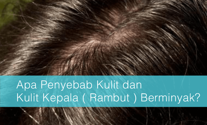 Rambut Berminyak: Penyebab dan Solusi untuk Menyingkirkan Kilau yang Mengganggu