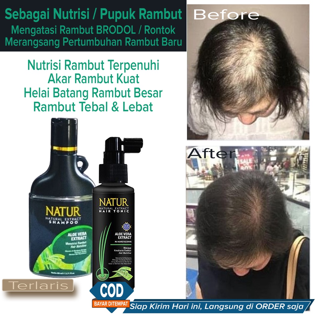 Rahasia Rambut Sehat: Zat Besi dan Nutrisi Pendukungnya