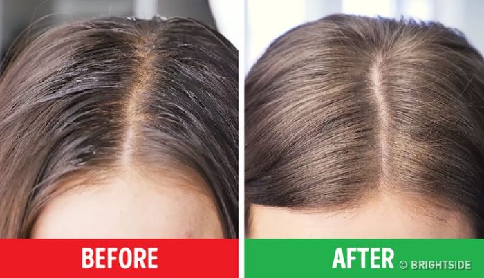 Rambut Lepek? Mungkin Tubuhmu Kekurangan Nutrisi!