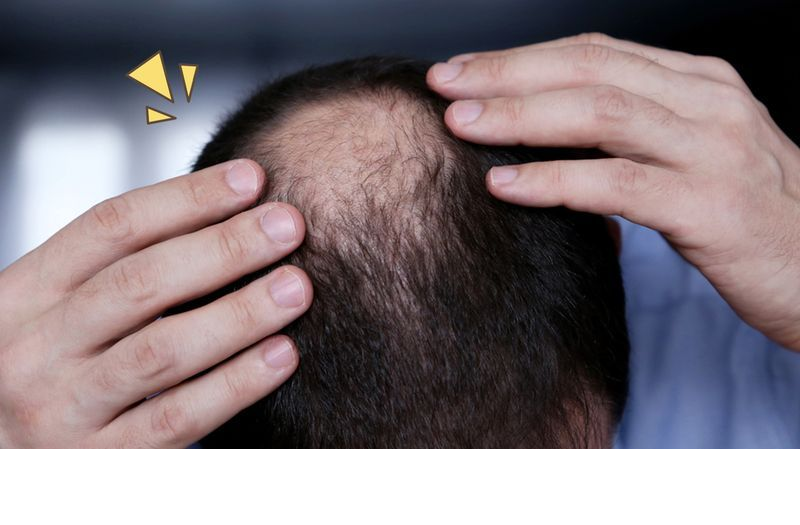 Ingin Rambut Lebat dan Panjang dalam Waktu Singkat? Rahasia Pertumbuhan Rambut yang Optimal Terkuak!