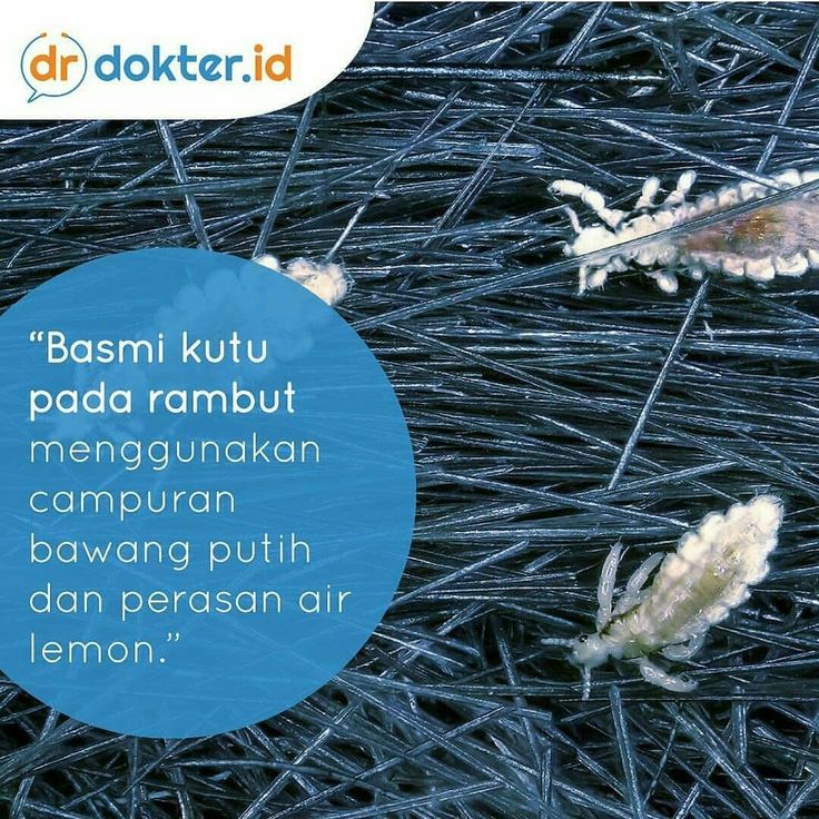 Bagaimana Kutu Rambut Bisa Muncul: Mengungkap Misteri Si Penghisap Darah