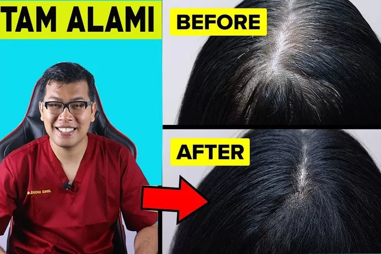 Rambut Putih, Bisakah Kembali Hitam? Menyingkap Misteri Penuaan dan Kembalinya Warna Rambut