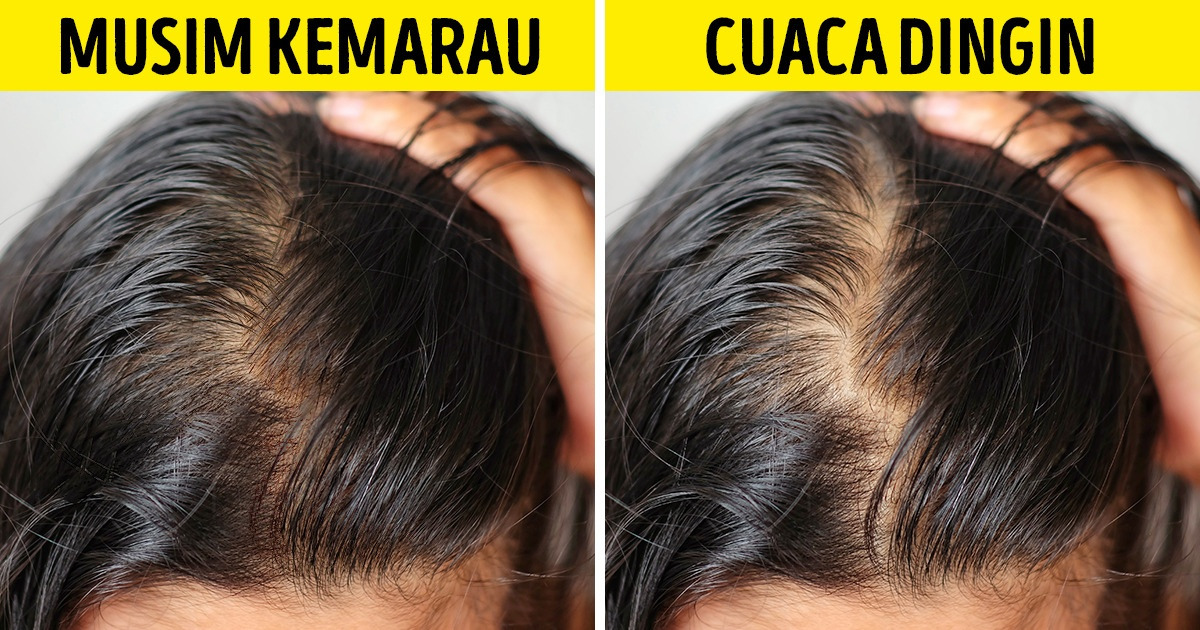 Apa yang Memengaruhi Pertumbuhan Rambut? Inilah Penjelasannya!