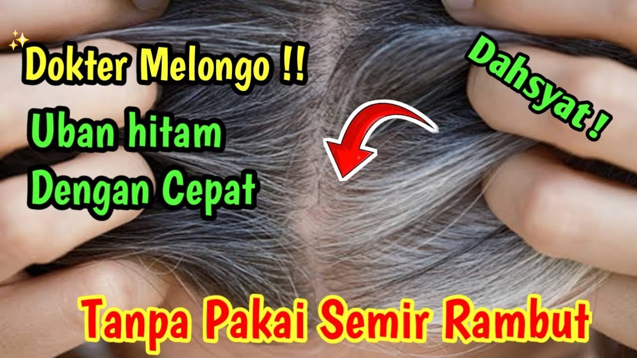 Rambut Putih: Cabut atau Biarkan?