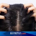 Ketombe Basah: Musuh Rambut Kusut yang Sering Diabaikan