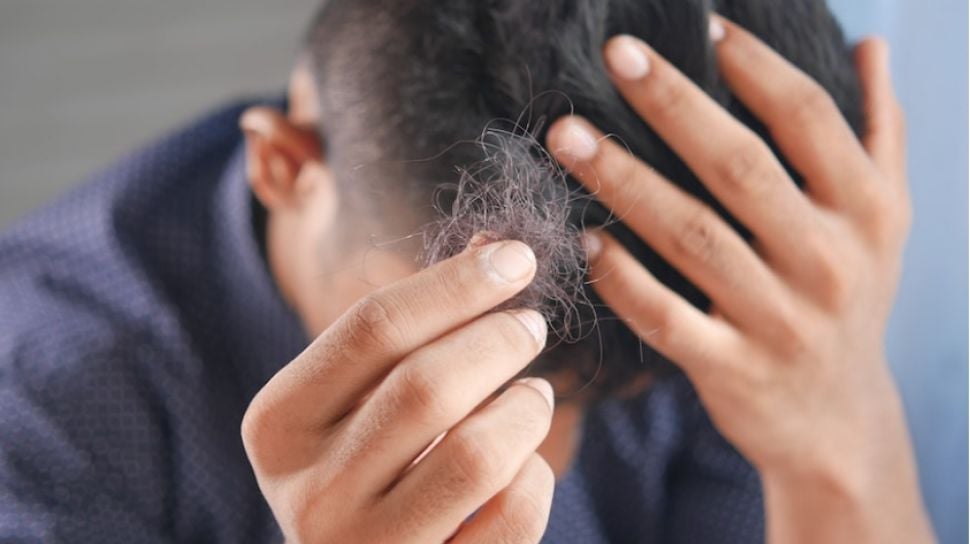 Bisakah Rambut yang Rontok Akibat Bleaching Tumbuh Kembali?