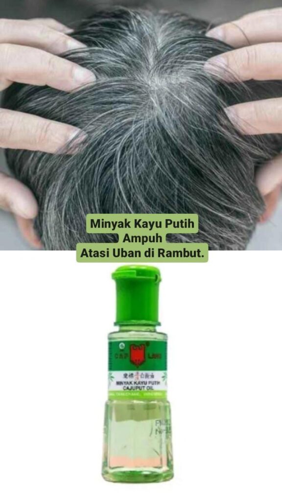 Mengusir Kutu Rambut dengan Minyak Kayu Putih: Benarkah Efektif?