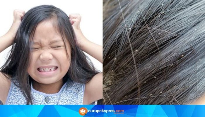 Gatal Tak Tertahankan? Begini Cara Menghilangkan Kutu di Rambut!