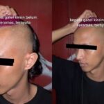 Rambut Putih, Bikin Gatal? Mitos atau Fakta?