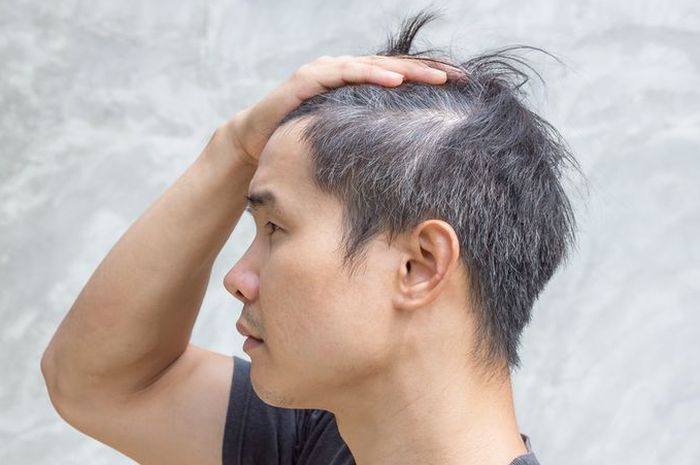 Rambut Putih: Cabut atau Biarkan?