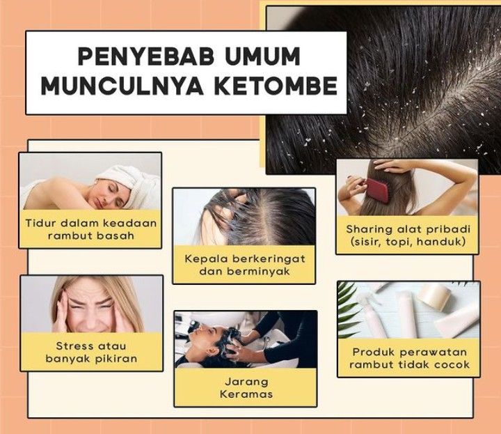 Berjuang Melawan Ketombe di Rambut Lurus? Solusi Alami yang Ampuh!