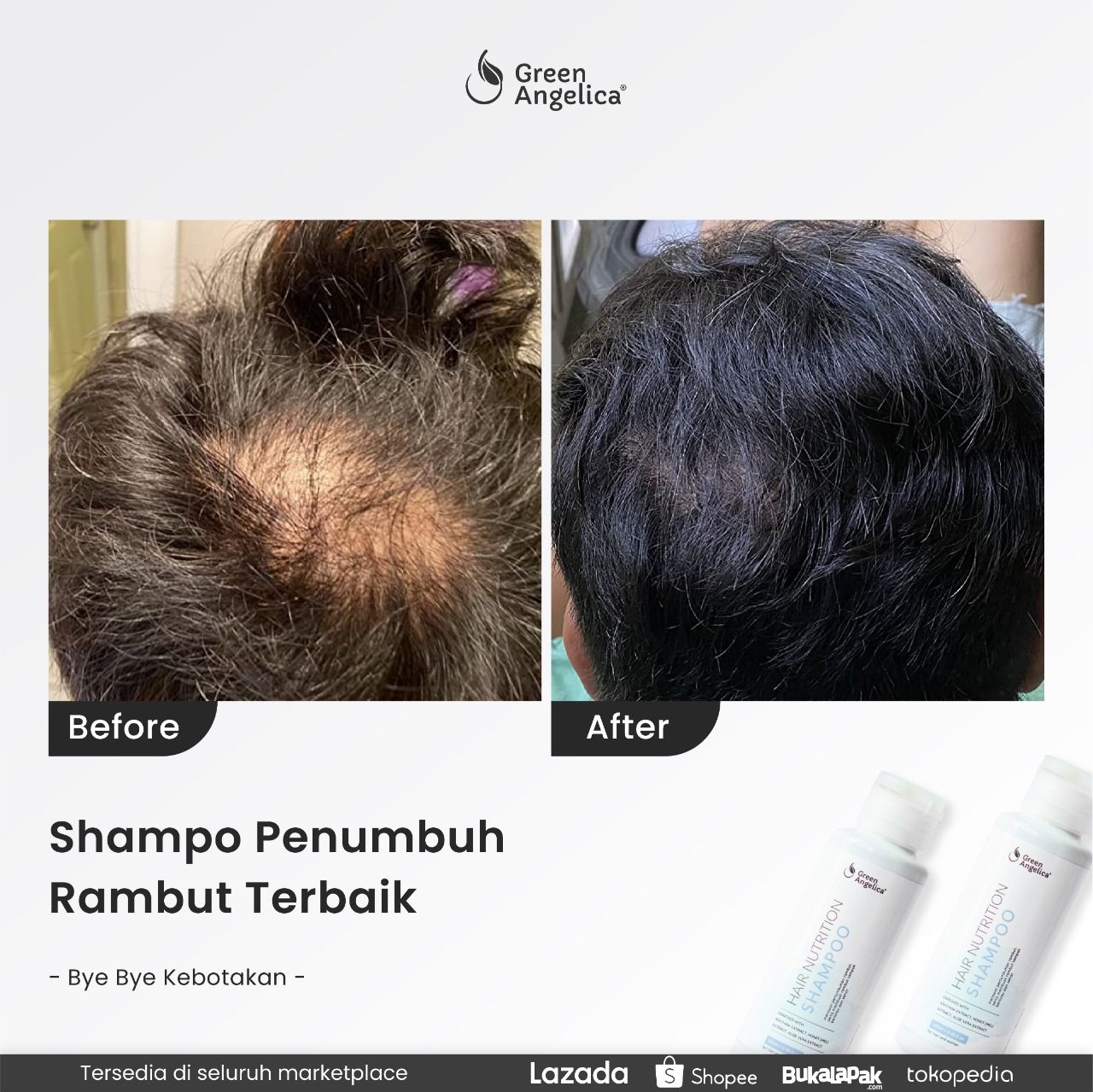 Apakah Vitamin K Membantu Menguatkan Akar Rambut? Menyingkap Rahasia Rambut Sehat dan Kuat