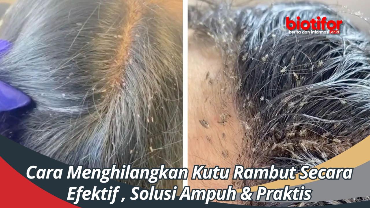 Cara Menghilangkan Kutu Rambut dengan Lemon: Solusi Alami yang Efektif?