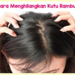 Kutu Rambut Bikin Jengkel? Atasi dengan Baking Soda!