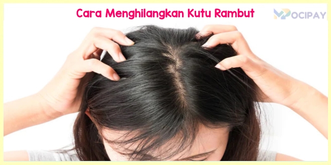 Kutu Rambut Bikin Jengkel? Atasi dengan Baking Soda!