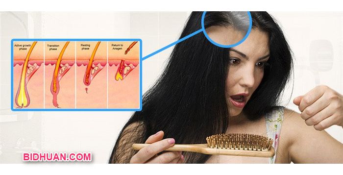 Rambut Rontok? Atasi dengan Nutrisi yang Tepat!